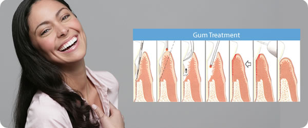 Gum Treatment