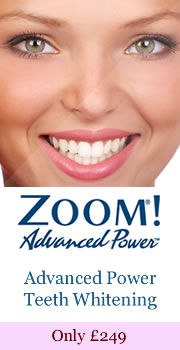 Teeth Whitening Offer