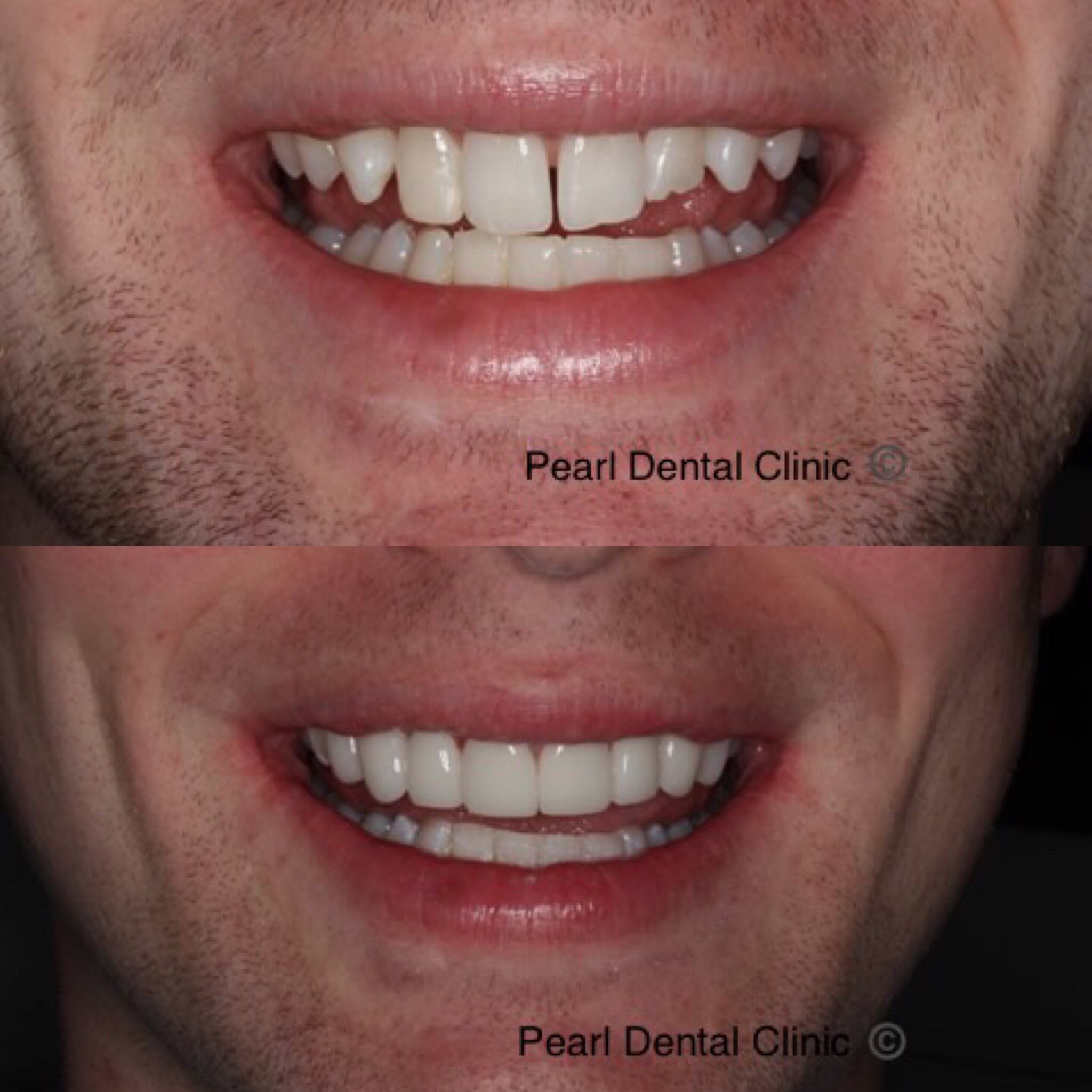 Dr Guy discusses Ant and Dec’s cosmetic dentistry