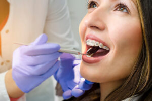 dentist braces
