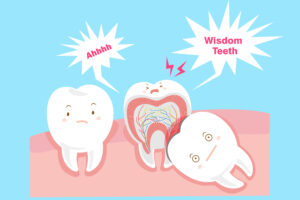 wisdom teeth removal price