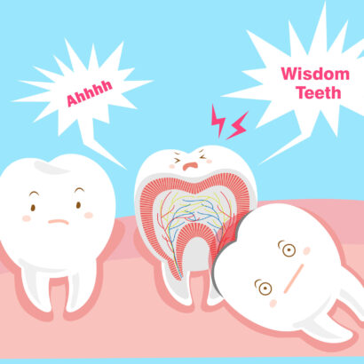 What to take for Wisdom tooth pain