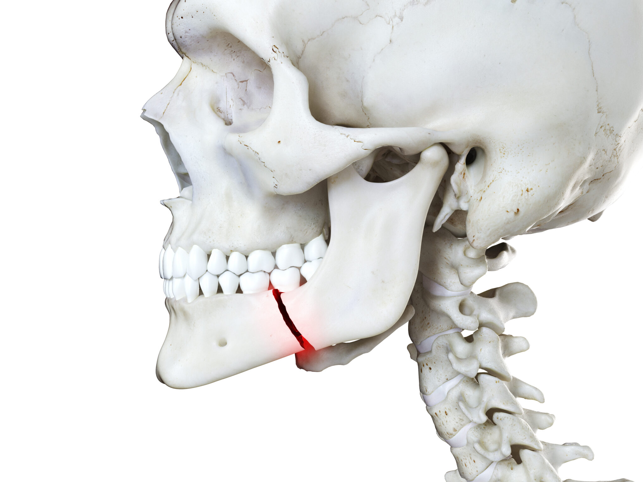 Jaw injuries management Emergency Dentist in Kingston, London