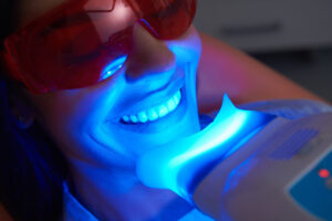 prices for teeth whitening