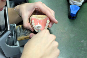 emergency denture repairs