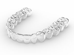 invisible braces