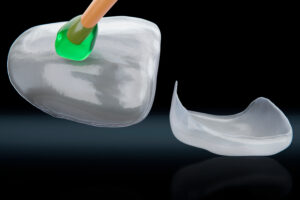 invisalign vs veneers