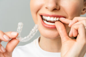 invisible braces