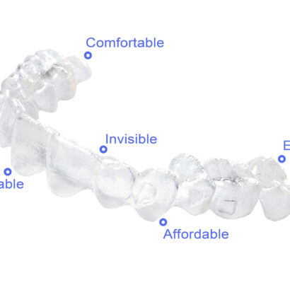 Aligners for Teeth: Straighten Your Smile
