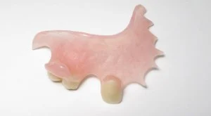 acrylic denture
