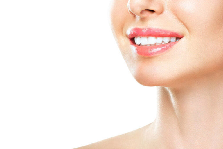 Do Composite veneers stain? Cosmetic Dentist in London