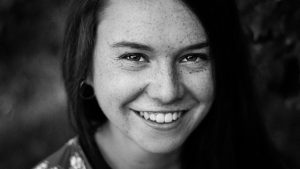 What Are Dental Veneers?