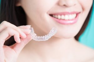 Invisalign frequently asked questions 
