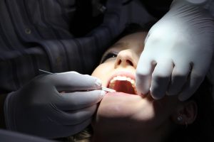 Black Tooth Treatment