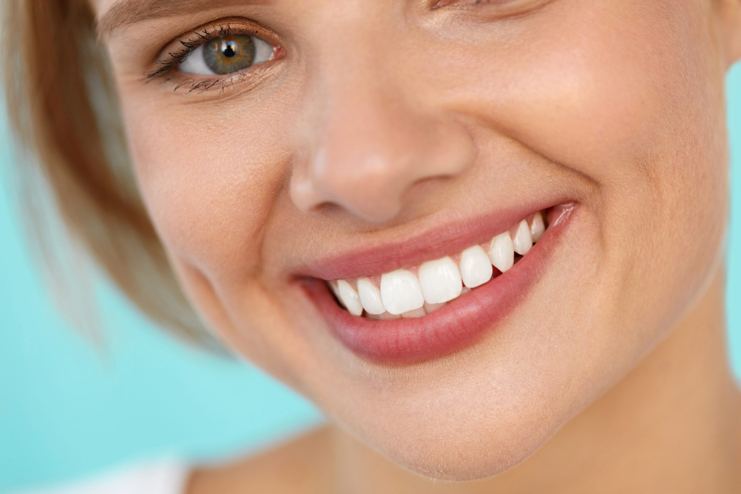 teeth whitening
