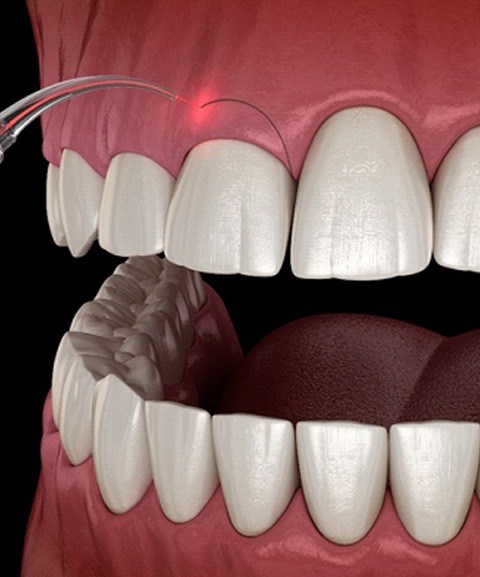 Smile Makeovers London