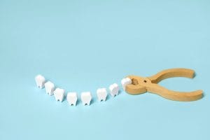 cost of tooth extraction