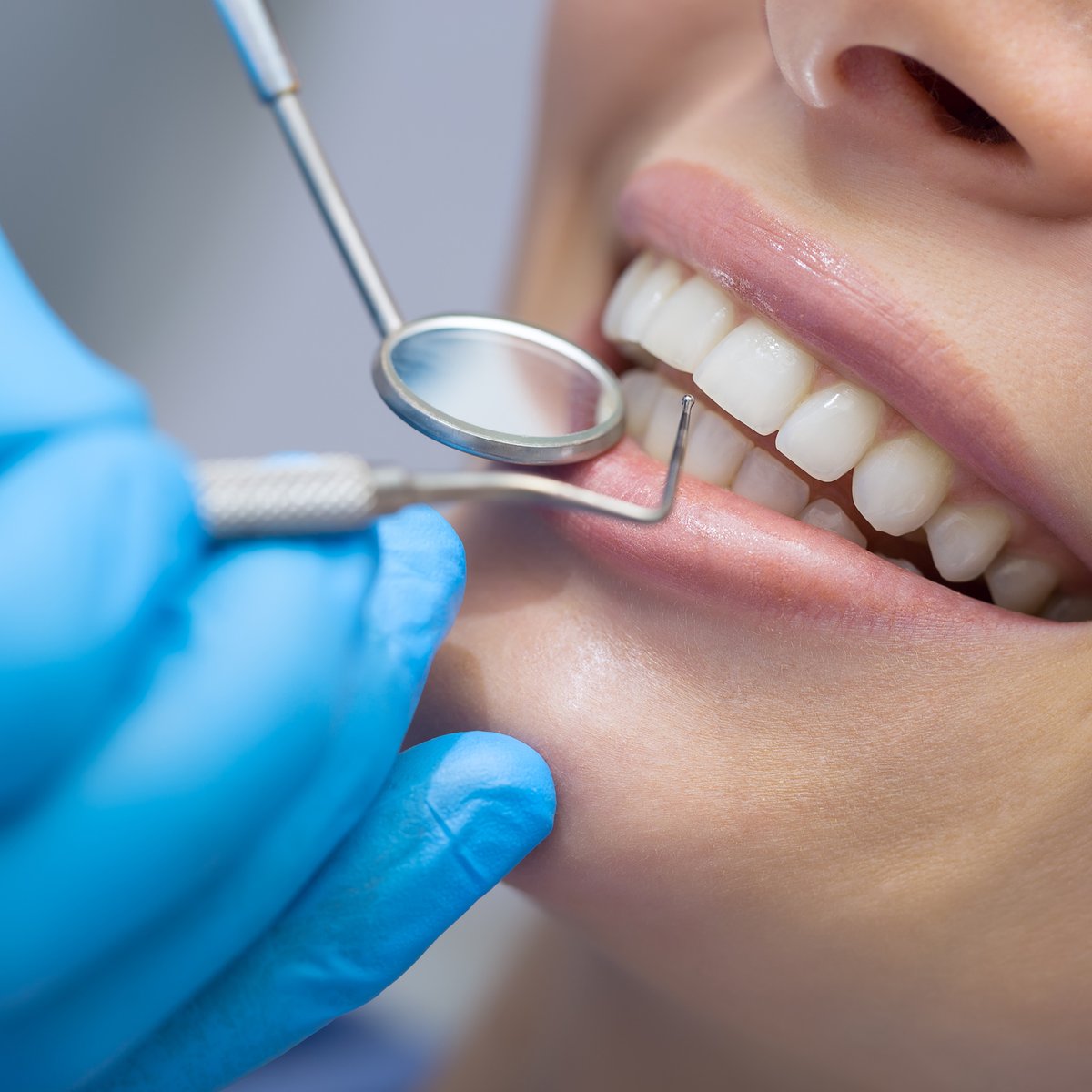 Composite Resin Bonding vs Veneers: Which Cosmetic Dental Treatment Is Right for You?