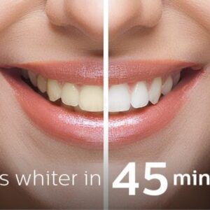 teeth whitening