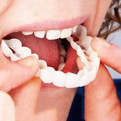 Veneer and Snap On Smile Reviews