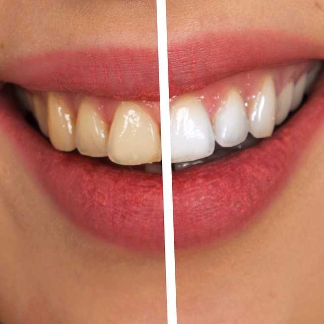 Mel Shilling shows off her gorgeous white teeth