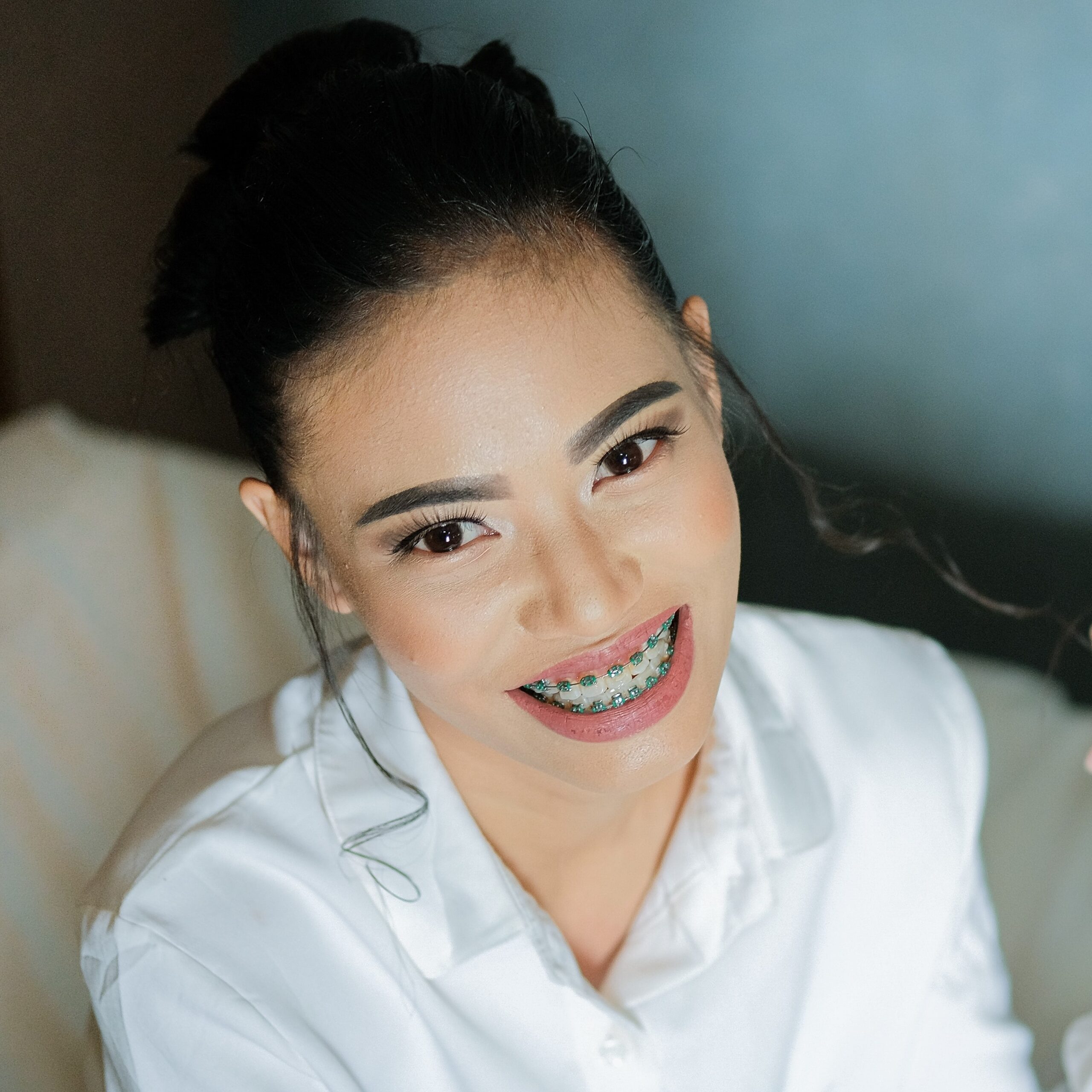 Teeth Straightening Options For Adults