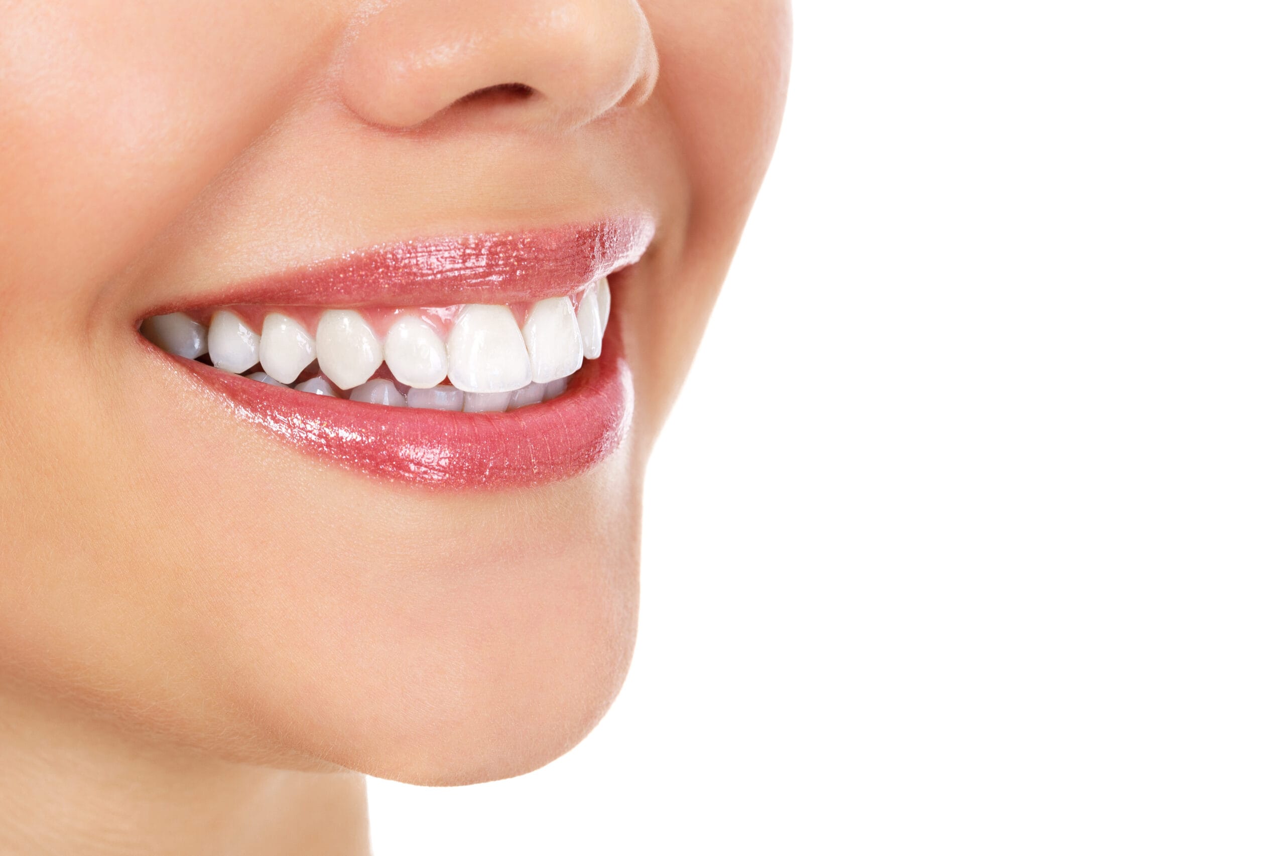 Where Can I Get My Teeth Whitened