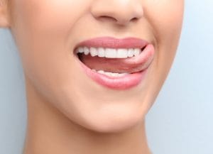 composite bonding smile