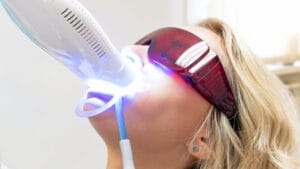 hollywood teeth whitening
