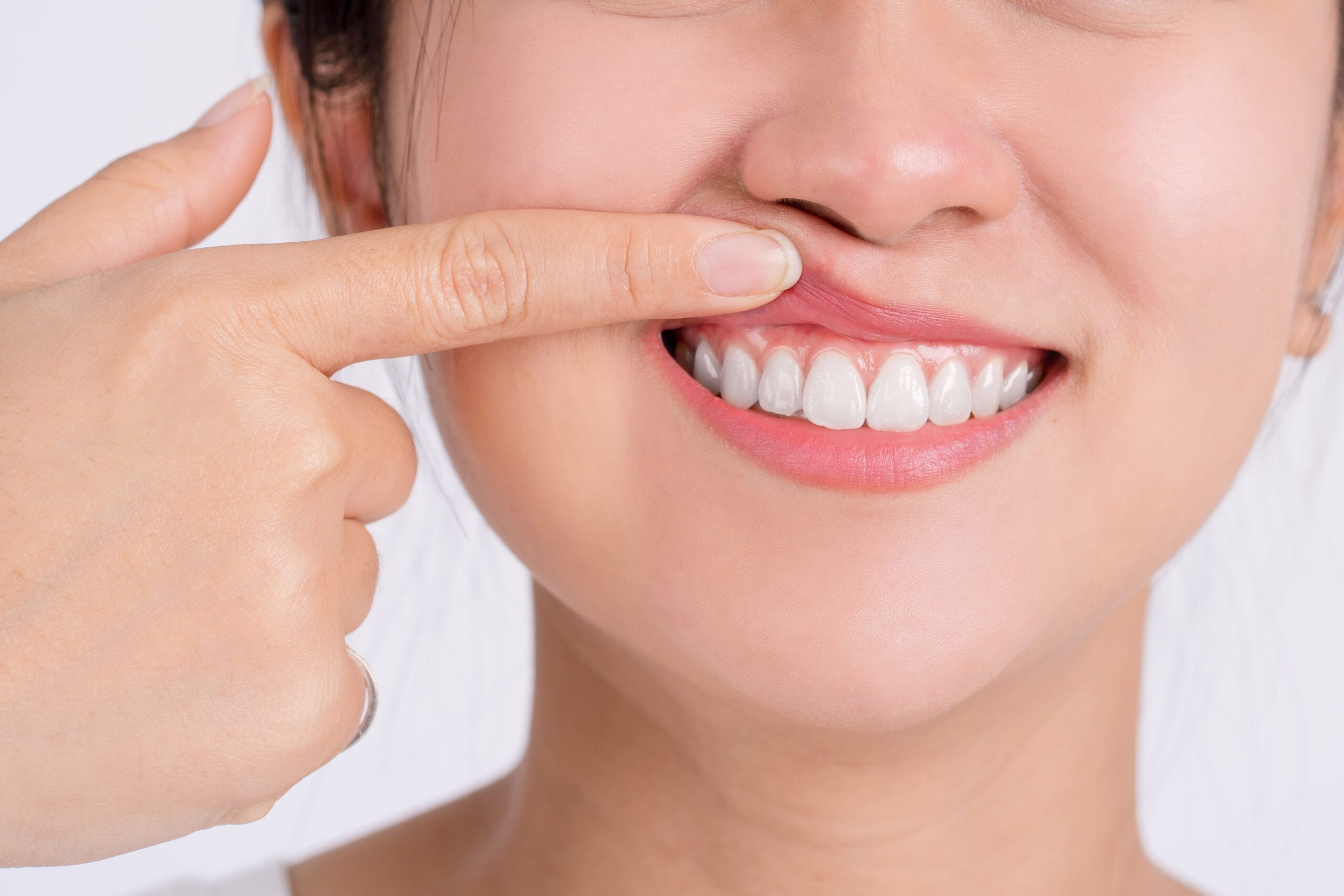 gum abscess treatment