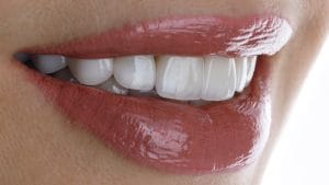 cosmetic dentistry