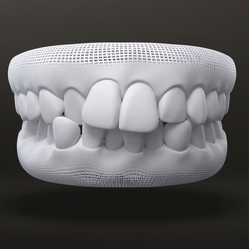 Crowded teeth 3d modal