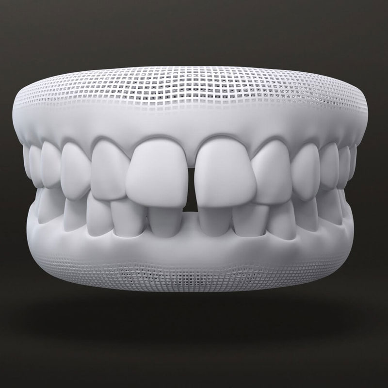 Gapped teeth 3d modal