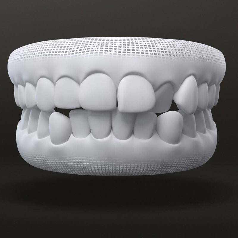 Misalignment 3d modal