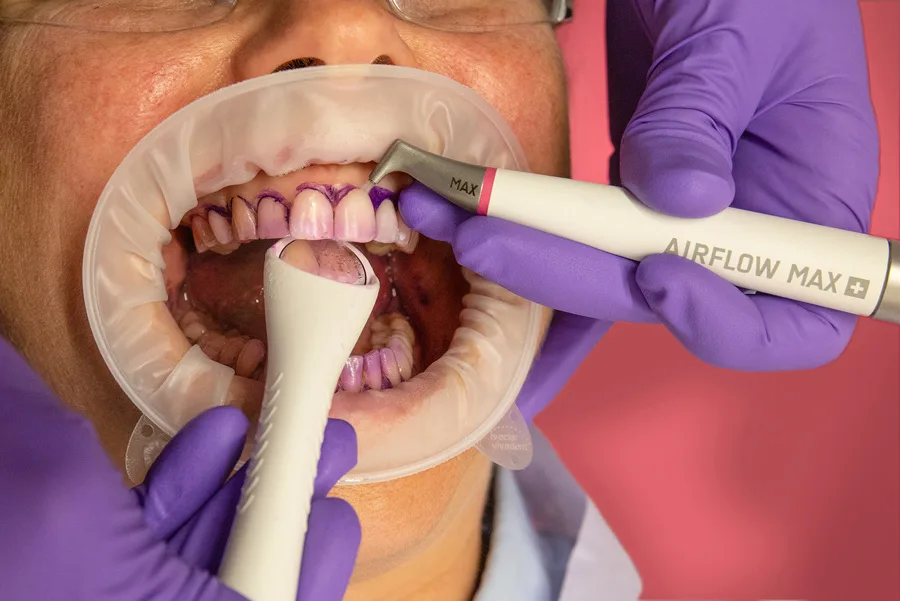 Sore Gums