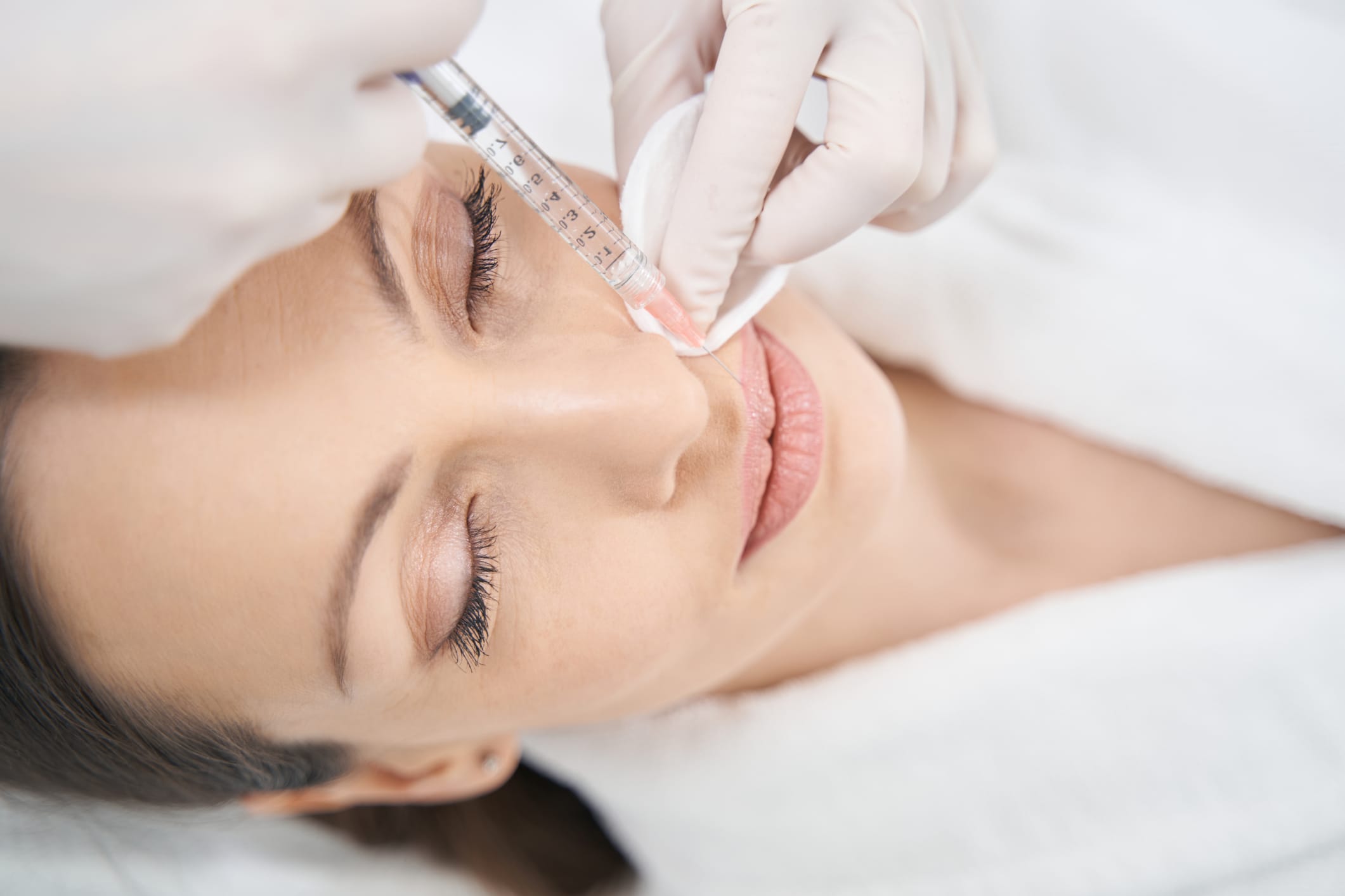 Dermal Fillers
