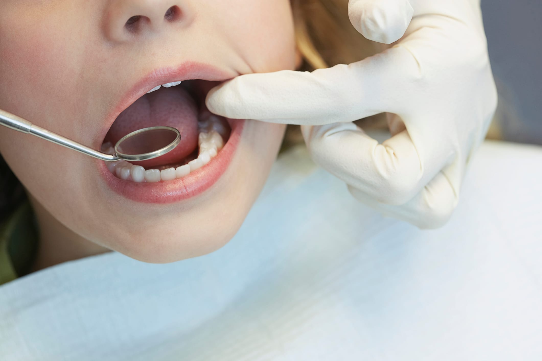 Dental Injuries in Children