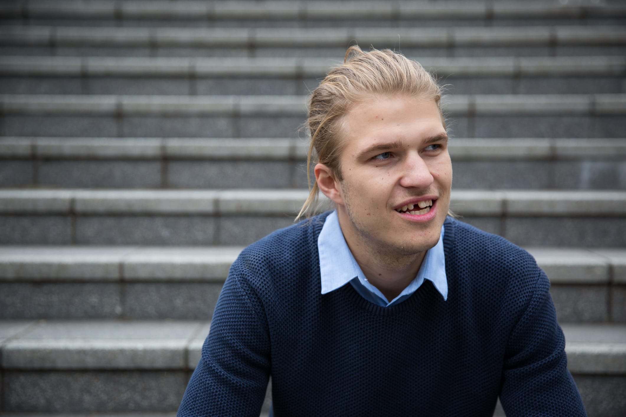 Avulsed Tooth (Knocked Out Tooth)