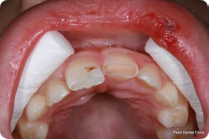 Dental trauma case study image 3