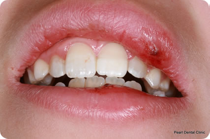 Dental trauma case study image 4