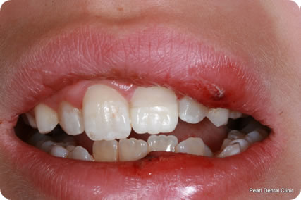 Dental trauma case study image 5