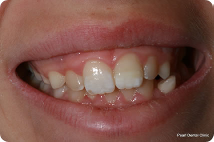 Dental trauma case study image 6