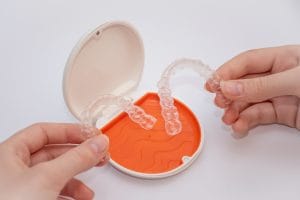 Vivera Retainers
