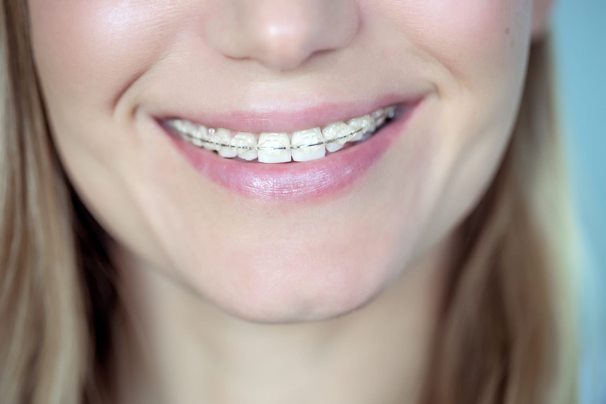 Why you should see a specialist orthodontist in New Malden