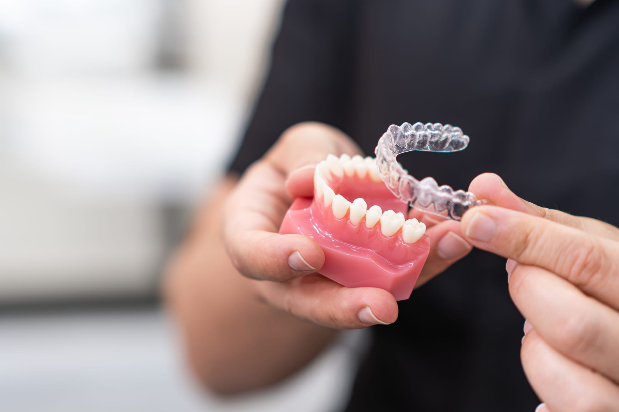 Why you should see a specialist orthodontist in New Malden