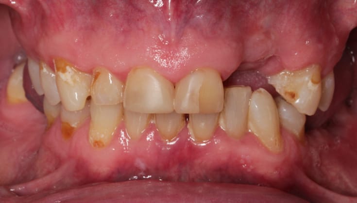 Before