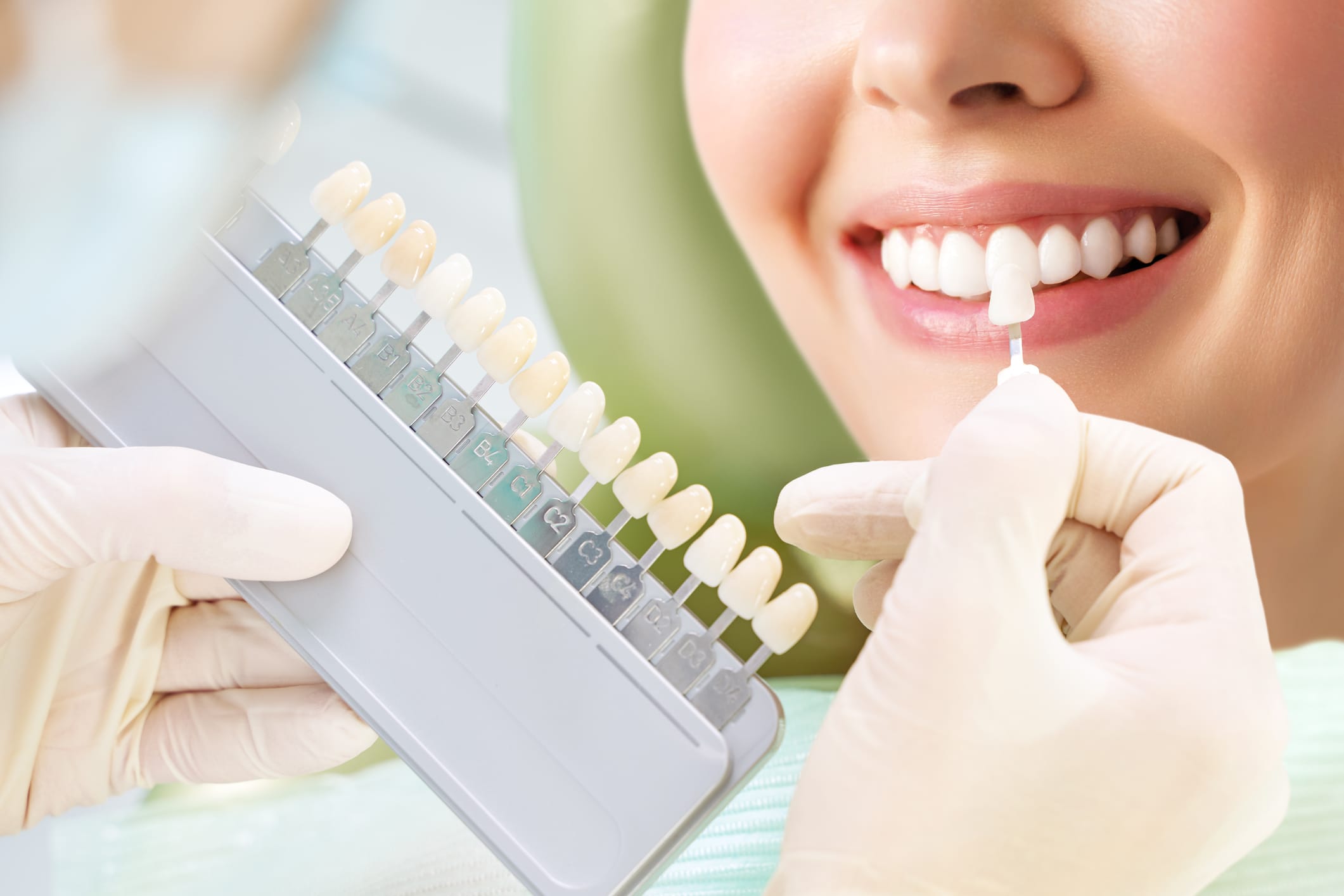 Brightening your smile with teeth whitening in Kingston