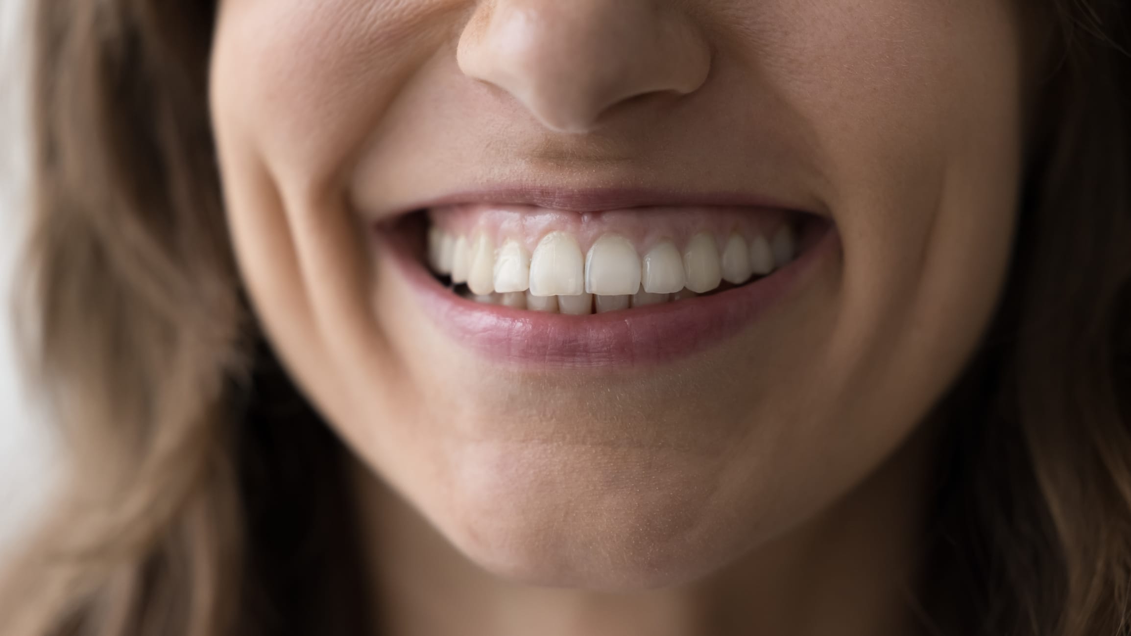 Enhancing your smile with gummy smile correction in Sutton