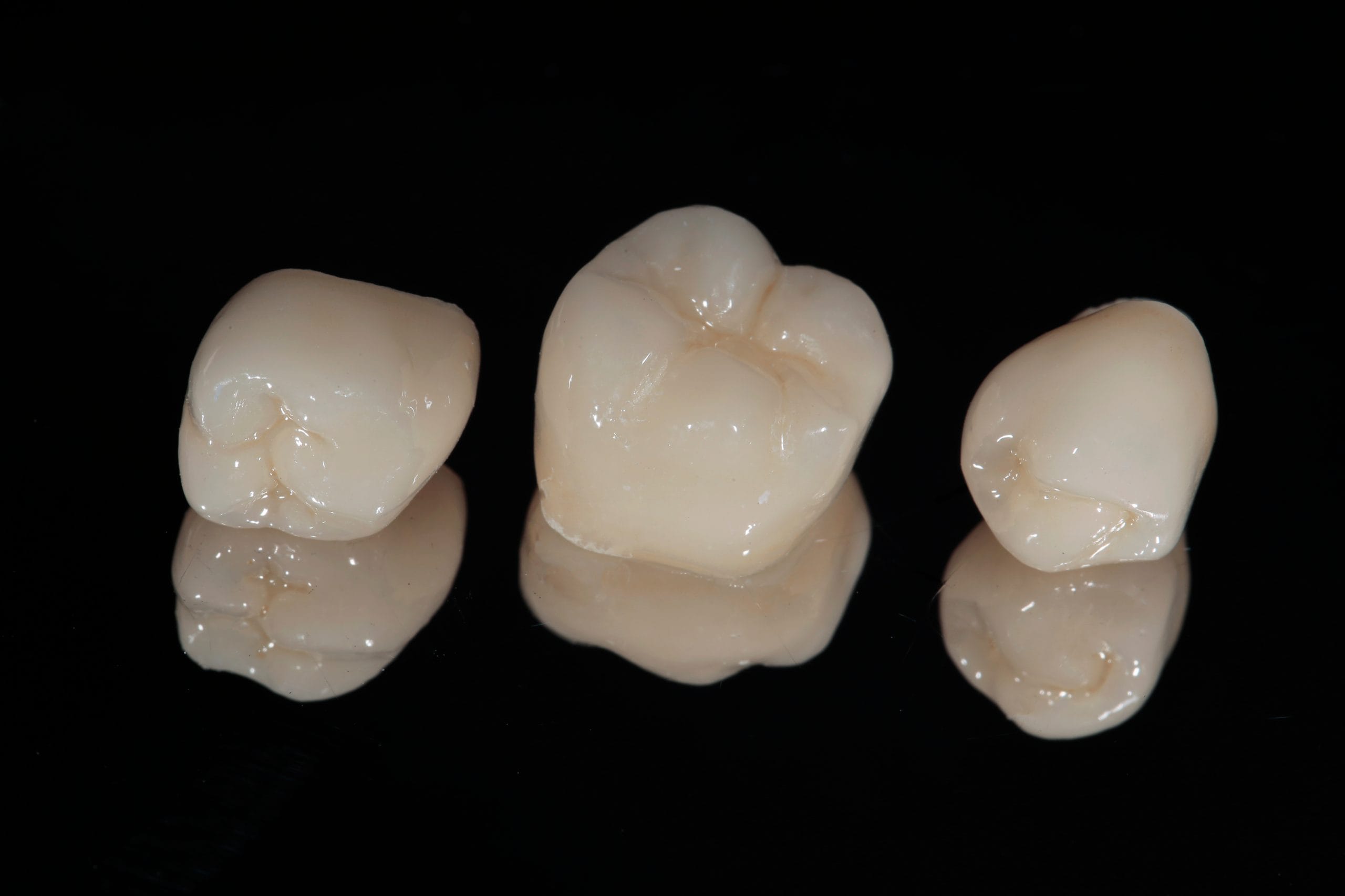 cerec tooth crown