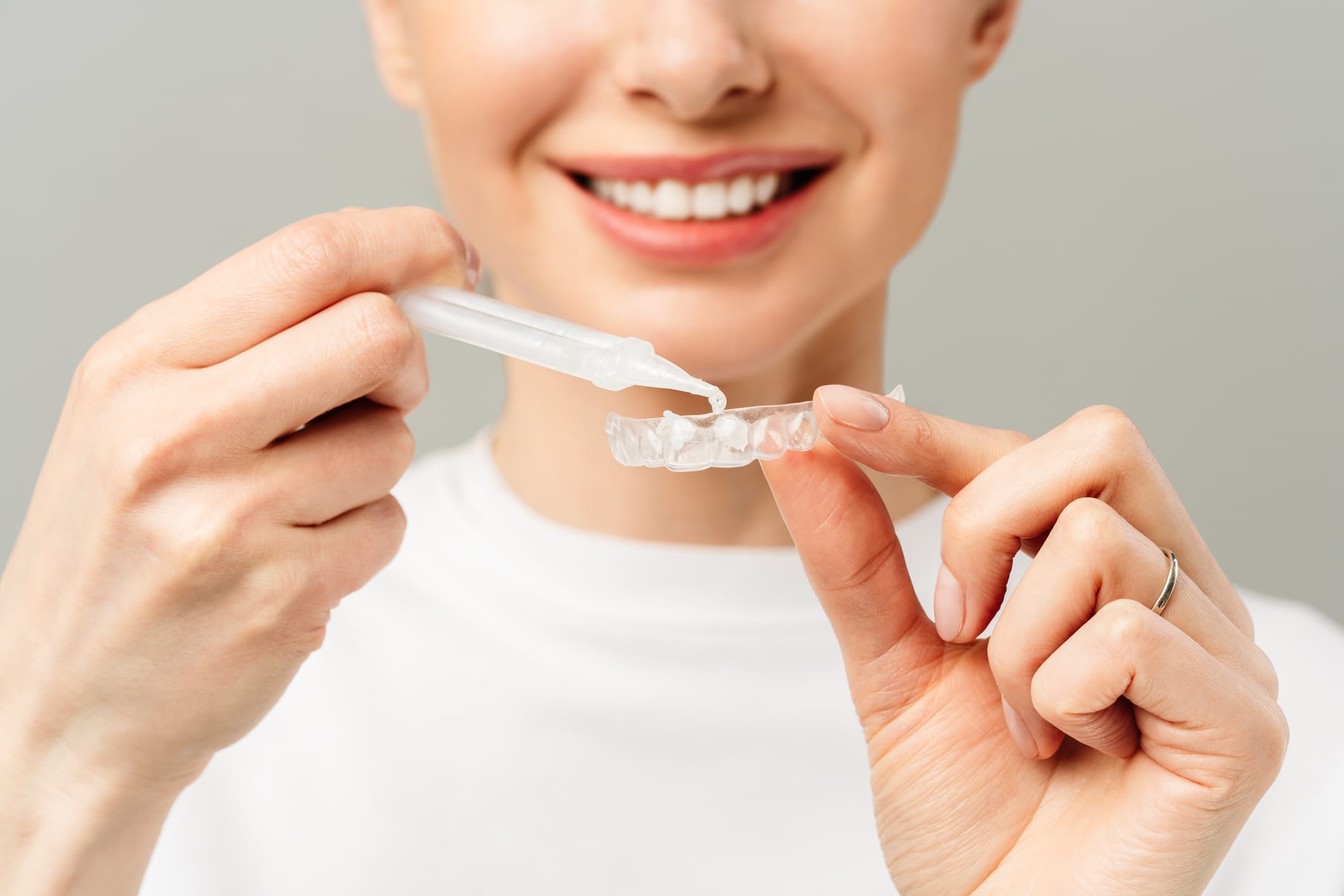 Brighten your smile in New Malden: How professional teeth whitening really works
